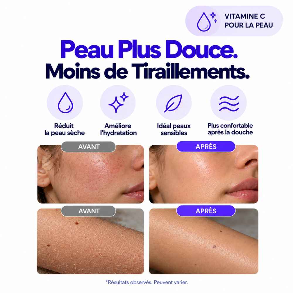 NEREA™ – Filtre de Douche à la Vitamine C Anti-Chlore
